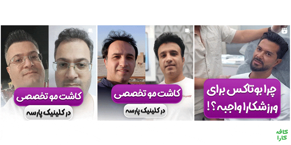 نمونه کار کلینیک پوست، مو و لیزر پارسه شیراز