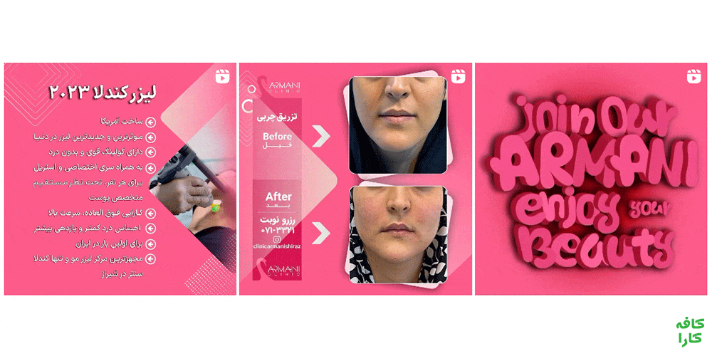پست اینستاگرام کلینیک آرمانی