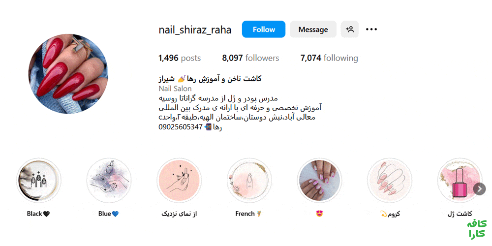 کاشت ناخن رها