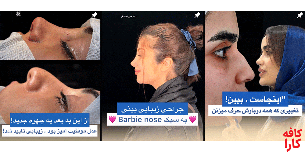 نمونه کار دکتر عبدالرضا خورشیدی فر