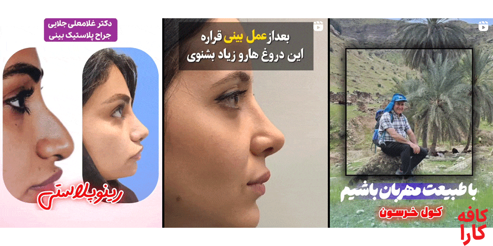 نمونه کار دکتر غلامعلی جلایی