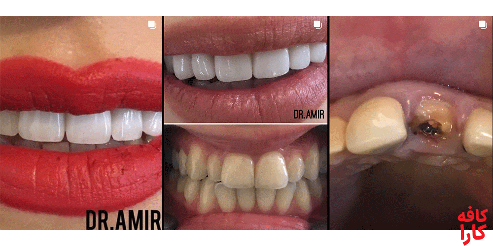 نمونه کار دکتر امیر صالح