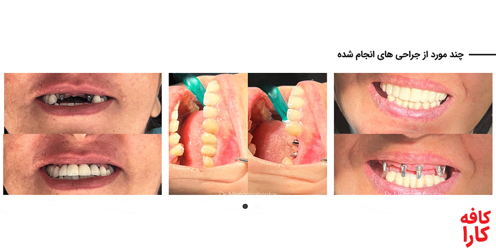 نمونه کار دکتر نیکنام جهانفر