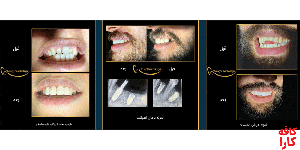 نمونه کار دکتر زکیه پورذکریا