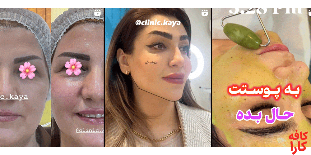 خدمات کلینیک زیبایی کایا