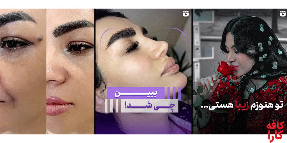 نمونه کار کلینیک زیبایی نیلوفر
