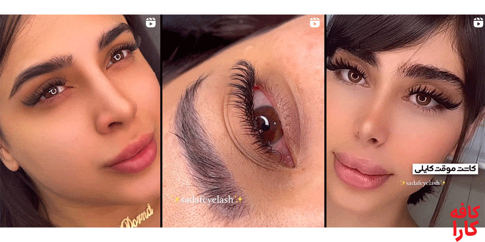 نمونه کار مرکز کاشت مژه صدف