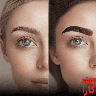 بهترین کاشت ابرو در کرج