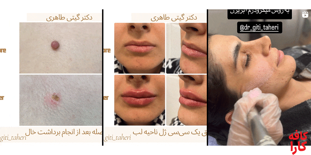 انواع بیماریهای پوست، مو و ناخن را بهخوبی تشخیص داده